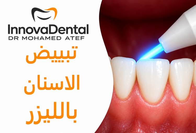 Laser Teeth Whitening For a More Beautiful Smile